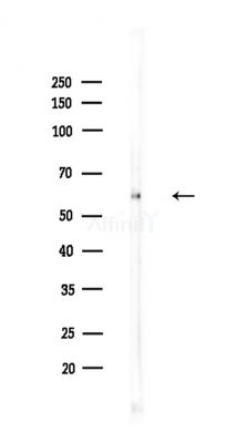 TRIM14 Antibody - Western blot analysis of lysates from A375 cells(LPS,4h treatment), using TRIM14 Antibody at 1/1000 dilution.