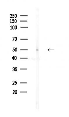 TRIM14 Antibody - Western blot analysis of lysates from Hela cells(heat-shock,45min treatment), using TRIM14 Antibody at 1/1000 dilution.