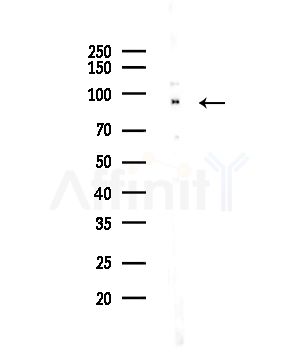 TRPC4AP Antibody - Western blot analysis of lysates from COLO205 cells(UV,30min treatment), using TRPC4AP Antibody at 1/1000 dilution.