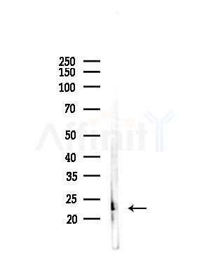 UBE2E2 Antibody - Western blot analysis of lysates from Mouse liver, using UBE2E2 Antibody at 1/1000 dilution.