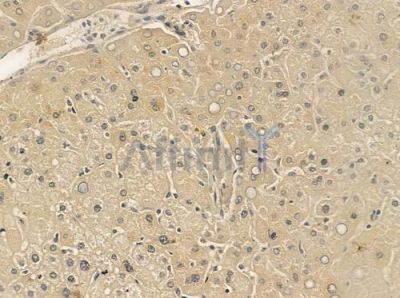 UBE2E2 Antibody - DF12493 at 1/100 staining human normal liver tissue by IHC-P.