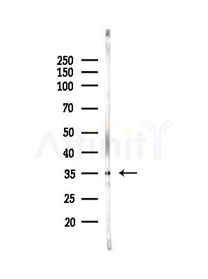 UFD1L Antibody - Western blot analysis of lysates from COLO205 cells(UV,30min treatment), using UFD1L Antibody at 1/1000 dilution.