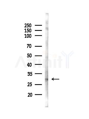 VDAC3 Antibody - Western blot analysis of lysates from MCF7 cells(heat-shock,45min treatment), using VDAC3 Antibody at 1/1000 dilution.