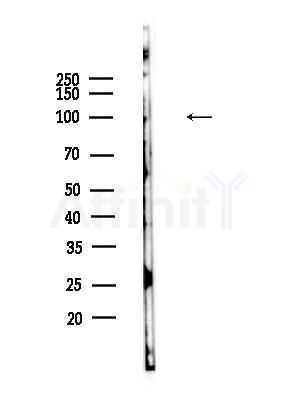 VPS11 Antibody - Western blot analysis of lysates from HepG2 cells(heat-shock,45min treatment), using VPS11 Antibody at 1/1000 dilution.