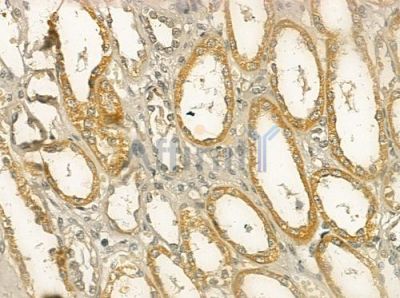 WISP1 Antibody - DF12503 at 1/100 staining human normal kidney tissue by IHC-P.