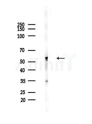WISP1 Antibody - Western blot analysis of lysates from EC304 cells(heat-shock,45min treatment), using WISP1 Antibody at 1/1000 dilution.