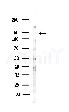 BCL9 Antibody - Western blot analysis of lysates from COLO205 cells(heat-shock,45min treatment), using BCL9 Antibody at 1/1000 dilution.