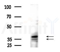 TRA2B Antibody - Western blot analysis of extracts from MCF7 cells(heat-shock,45min treatment), using TRA2B Antibody at 1/1000 dilution.