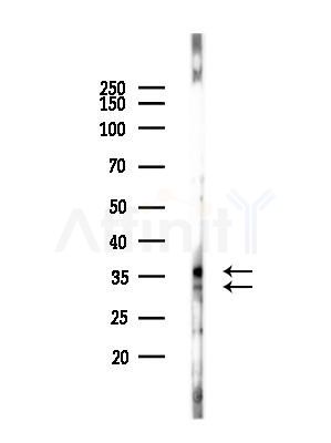 TRA2B Antibody - Western blot analysis of lysates from MCF7 cells(heat-shock,45min treatment), using TRA2B Antibody at 1/1000 dilution.