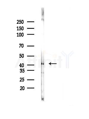 MTCH1 Antibody - Western blot analysis of lysates from B16F10-LUC cells(LPS,4h treatment), using MTCH1 Antibody at 1/1000 dilution.