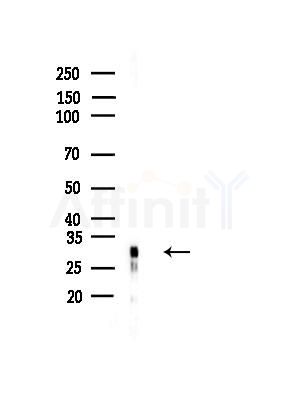 TM158 Antibody - Western blot analysis of lysates from B16F10-LUC cells(LPS,4h treatment), using TM158 Antibody at 1/1000 dilution.