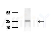CSF2 Antibody - Western blot analysis of extracts from Mouse liver, using CSF2 Antibody at 1/1000 dilution.