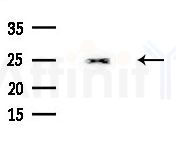 MFAP5 Antibody - Western blot analysis of extracts from Mouse liver, using MFAP5 Antibody at 1/1000 dilution.