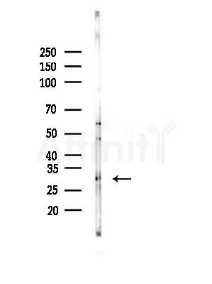 TMEM9 Antibody - Western blot analysis of lysates from B16F10-LUC cells(LPS,4h treatment), using TMEM9 Antibody at 1/1000 dilution.