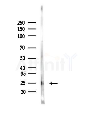 TMEM9 Antibody - Western blot analysis of lysates from 3T3-L1 cells(heat-shock, 45min treatment), using TMEM9 Antibody at 1/1000 dilution.