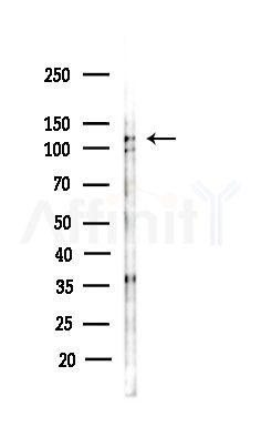 NUTM1 Antibody - Western blot analysis of lysates from COLO205 cells(heat-shock,45min treatment), using NUTM1 Antibody at 1/1000 dilution.