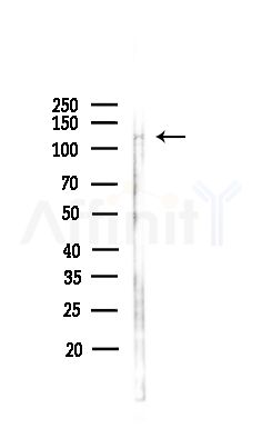 NUTM1 Antibody - Western blot analysis of lysates from Hela cells(heat-shock,45min treatment), using NUTM1 Antibody at 1/1000 dilution.