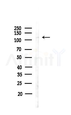 NUCL Antibody - Western blot analysis of lysates from Hela cells(heat-shock,45min treatment), using NUCL Antibody at 1/1000 dilution.