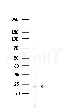 SIKE1 Antibody - Western blot analysis of lysates from COLO205 cells(heat-shock,45min treatment), using SIKE1 Antibody at 1/1000 dilution.