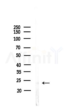 SIKE1 Antibody - Western blot analysis of lysates from Hela cells(heat-shock,45min treatment), using SIKE1 Antibody at 1/1000 dilution.