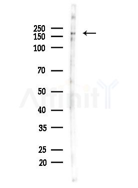 TITIN Antibody - Western blot analysis of lysates from EC304 cells, using TITIN Antibody at 1/1000 dilution.