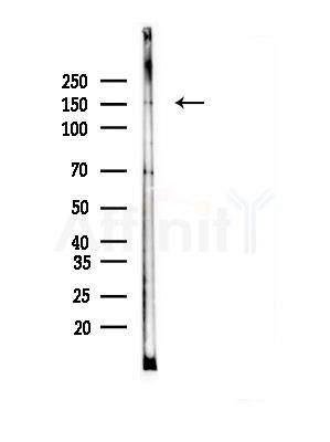KDM2B Antibody - Western blot analysis of lysates from B16F10-LUC cells(LPS,4h treatment), using KDM2B Antibody at 1/1000 dilution.