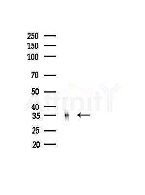 MSI2H Antibody - Western blot analysis of lysates from B16F10-LUC cells(LPS,4h treatment), using MSI2H Antibody at 1/1000 dilution.