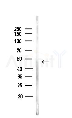 ACTR10 Antibody - Western blot analysis of lysates from Hela cells(heat-shock,45min treatment), using ACTR10 Antibody at 1/1000 dilution.