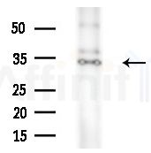ARPC2 Antibody - Western blot analysis of extracts from A375 cells(heat-shock treatment), using ARPC2 Antibody at 1/1000 dilution.