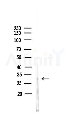 ATP6V1E1 Antibody - Western blot analysis of lysates from Hela cells(heat-shock,45min treatment), using ATP6V1E1 Antibody at 1/1000 dilution.