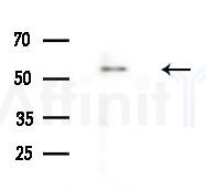BBS9 Antibody - Western blot analysis of extracts from B16F10-LUC cells
(LPS 4h treatment), using BBS9 Antibody at 1/1000 dilution.