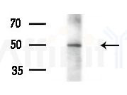 BBS9 Antibody - Western blot analysis of extracts from Mouse liver, using BBS9 Antibody at 1/1000 dilution.