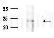 BTG1 Antibody - Western blot analysis of extracts from Mouse liver, using BTG1 Antibody at 1/1000 dilution.