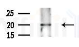 C18orf55 Antibody - Western blot analysis of extracts from 3T3-L1 cells
(heat-shock treatment), using C18orf55 Antibody at 1/1000 dilution.
