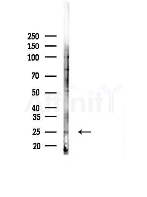 C18orf55 Antibody - Western blot analysis of lysates from 3T3-L1 cells(heat-shock, 45min treatment), using C18orf55 Antibody at 1/1000 dilution.