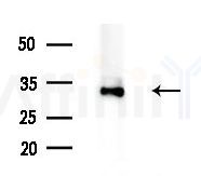 C19orf52 Antibody - Western blot analysis of extracts from 3T3-L1 cells
(heat-shock treatment), using C19orf52 Antibody at 1/1000 dilution.