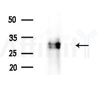 C19orf52 Antibody - Western blot analysis of extracts from Rat brain, using C19orf52 Antibody at 1/1000 dilution.