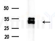 C19orf52 Antibody - Western blot analysis of extracts from B16F10-LUC cells
(LPS 4h treatment), using C19orf52 Antibody at 1/1000 dilution.