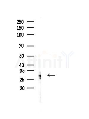 C19orf52 Antibody - Western blot analysis of lysates from Mouse liver, using C19orf52 Antibody at 1/1000 dilution.