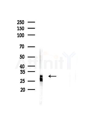 C19orf52 Antibody - Western blot analysis of lysates from B16F10-LUC cells(LPS,4h treatment), using C19orf52 Antibody at 1/1000 dilution.