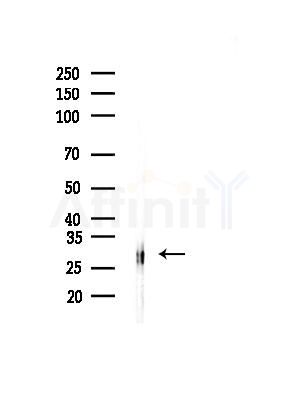 C19orf52 Antibody - Western blot analysis of lysates from Rat brain, using C19orf52 Antibody at 1/1000 dilution.