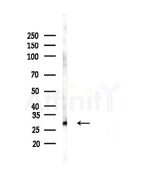 C19orf52 Antibody - Western blot analysis of lysates from 3T3-L1 cells(heat-shock, 45min treatment), using C19orf52 Antibody at 1/1000 dilution.