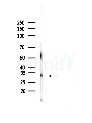 CHMP2B Antibody - Western blot analysis of lysates from B16F10-LUC cells(LPS,4h treatment), using CHMP2B Antibody at 1/1000 dilution.