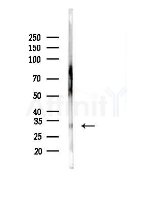 CHMP2B Antibody - Western blot analysis of lysates from Rat brain, using CHMP2B Antibody at 1/1000 dilution.