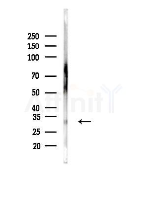 CHMP2B Antibody - Western blot analysis of lysates from 3T3-L1 cells(heat-shock, 45min treatment), using CHMP2B Antibody at 1/1000 dilution.