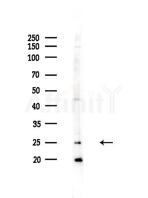 COMMD5 Antibody - Western blot analysis of lysates from Hela cells(starvation,24h treatment), using COMMD5 Antibody at 1/1000 dilution.