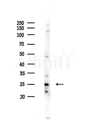 COMMD5 Antibody - Western blot analysis of lysates from A375 cells(heat-shock,45min treatment), using COMMD5 Antibody at 1/1000 dilution.