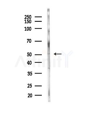 COQ6 Antibody - Western blot analysis of lysates from Hela cells(LPS,4h treatment), using COQ6 Antibody at 1/1000 dilution.