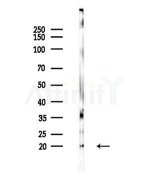 CPLX3 Antibody - Western blot analysis of lysates from Rat brain, using CPLX3 Antibody at 1/1000 dilution.