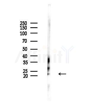 CPLX3 Antibody - Western blot analysis of lysates from HUVEC cells(UV,30min treatment), using CPLX3 Antibody at 1/1000 dilution.